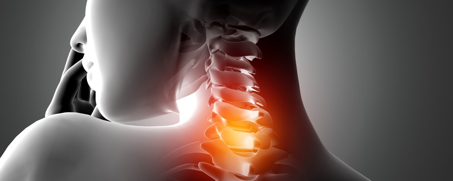 dolor cervical